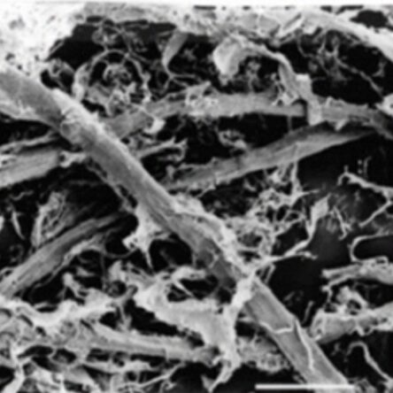 Mejora del proceso productivo de reciclaje del papel mediante el refinado de la pasta con enzimas